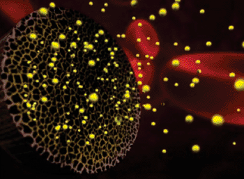 Image: In this rendering, RNA-carrying "nanoliposomes" (yellow) are released from a silicon nanoparticle (grey) near targeted ovarian cancer cells (not pictured). Intravenous injections of the microscopic drug delivery system in animal models appear to have resulted in anywhere from a 36% to 83% reduction in ovarian tumor weight, depending on the dose administered (Photo courtesy of Haifa Shen and Mauro Ferrari, Methodist Hospital Research Institute).